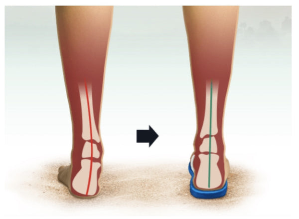 ARCHLINE Orthotic Thongs Arch Support Shoes Footwear Flip