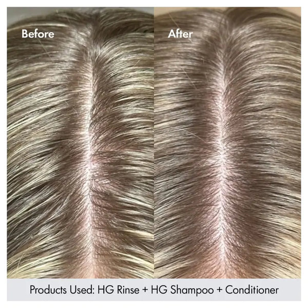 Bondi Boost Hair Growth Clarifying Rinse - Haircare